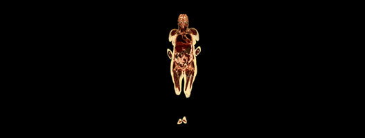 img.transverse